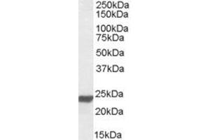 Western Blotting (WB) image for anti-High Mobility Group Box 3 (HMGB3) (AA 165-179) antibody (ABIN490535) (HMGB3 anticorps  (AA 165-179))