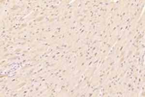 Immunohistochemistry analysis of paraffin-embedded mouse heart using,ZFP90 (ABIN7076275) at dilution of 1: 4200