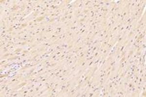 Immunohistochemistry analysis of paraffin-embedded mouse heart using,ZFP90 (ABIN7076275) at dilution of 1: 4200 (ZNF90 anticorps)