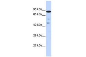 Image no. 1 for anti-RAD54-Like (RAD54L) (AA 216-265) antibody (ABIN6742672) (RAD54L anticorps  (AA 216-265))