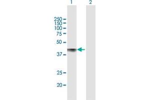 Western Blot analysis of CDCP1 expression in transfected 293T cell line by CDCP1 MaxPab polyclonal antibody. (CDCP1 anticorps  (AA 1-343))