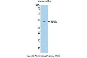 Western Blotting (WB) image for anti-Gap Junction Protein, beta 3, 31kDa (GJB3) (AA 213-270) antibody (ABIN1174652) (Connexin 31 anticorps  (AA 213-270))