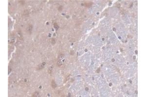 Detection of CD7 in Rat Cerebrum Tissue using Polyclonal Antibody to Cluster Of Differentiation 7 (CD7) (CD7 anticorps  (AA 23-128))
