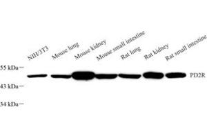 Western blot analysis of PD2R (ABIN7075206) at dilution of 1: 2000 (PTGDR anticorps)