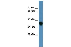 WB Suggested Anti-AKR1C1 Antibody Titration: 0. (AKR1C1 anticorps  (N-Term))