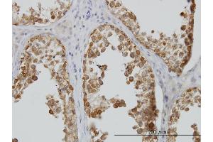 Immunoperoxidase of monoclonal antibody to DDX6 on formalin-fixed paraffin-embedded human testis. (DDX6 anticorps  (AA 1-483))
