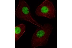 Fluorescent image of U251 cell stained with PGR/PR Antibody . (PGLYRP1 anticorps  (C-Term))