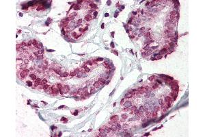 Anti-CD44 antibody IHC of human breast.