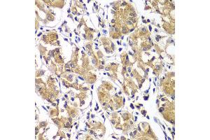 Immunohistochemistry of paraffin-embedded human gastric using DGKE antibody at dilution of 1:100 (40x lens). (DGKE anticorps)