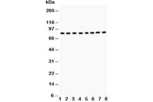 Western blot testing of BRAF antibody and Lane 1:  rat testis tissue;  2: rat brain tissue;  3: mouse testis tissue;  4: mouse brain tissue;  and human samples 5: HeLa;  6: Jurkat;  7: MCF-7;  8: K562 (BRAF anticorps  (AA 38-230))