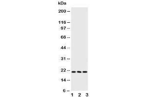 Western blot testing of FGF21 antibody and Lane 1:  human A549