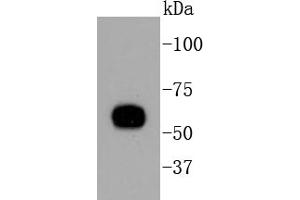 HeLa lysates, probed with Cytokeratin 10 (1D8) Monoclonal Antibody  at 1:1000 overnight at 4˚C. (Keratin 10 anticorps)