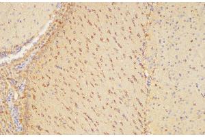 Immunohistochemistry of paraffin-embedded Mouse brain using PLAUR Ployclonal Antibody at dilution of 1:200. (PLAUR anticorps)