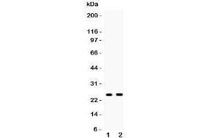 Western blot testing of PSCA antibody and Lane 1:  rat stomach;  2: mouse stomach;  Predicted size: 13KD;  Observed glycosylated size: up to 29KD (PSCA anticorps  (AA 21-95))