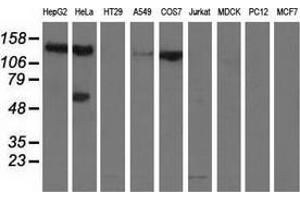 Western blot analysis of extracts (35 µg) from 9 different cell lines by using anti-L1CAM monoclonal antibody. (L1CAM anticorps)