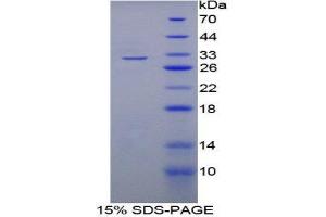 SDS-PAGE (SDS) image for Ataxin 2-Binding Protein 1 (A2BP1) (AA 149-399) protein (His tag) (ABIN2124076)