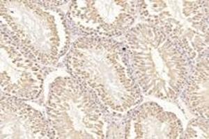 Immunohistochemistry analysis of paraffin-embedded mouse testis using,PSKH1 (ABIN7075291) at dilution of 1: 2800