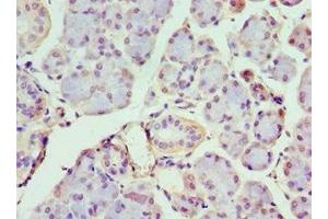 Immunohistochemistry of paraffin-embedded human pancreatic tissue using ABIN7156650 at dilution of 1:100 (IFIH1 anticorps  (AA 1-205))