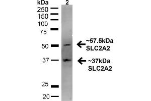 Western blot analysis of Rat Liver showing detection of ~57. (SLC2A2 anticorps  (C-Term) (PE))