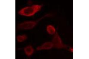 ABIN6266956 staining HeLa cells by IF/ICC. (CYP2U1 anticorps  (Internal Region))