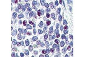 IHC analysis of FFPE human spleen tissue stained with KLF4 antibody