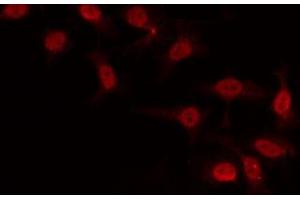 ABIN6266889 staining COLO205 by IF/ICC.