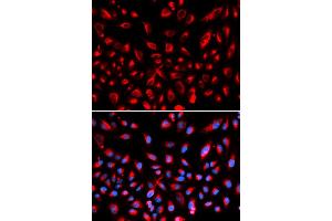 Immunofluorescence analysis of U2OS cells using CLDN11 antibody (ABIN5971415). (Claudin 11 anticorps)
