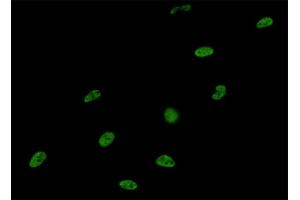Immunofluorescence of monoclonal antibody to SNRPA on HeLa cell.