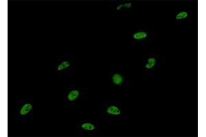 Immunofluorescence of monoclonal antibody to SNRPA on HeLa cell. (SNRPA1 anticorps  (AA 1-282))