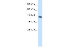 WB Suggested Anti-ZNF670 Antibody Titration:  1. (ZNF670 anticorps  (N-Term))