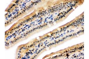 IHC analysis of NIRF using anti-NIRF antibody (ABIN3044559).