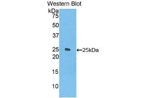 Detection of Recombinant FOLR4, Mouse using Polyclonal Antibody to Folate Receptor 4 (FOLR4) (Folate Receptor 4 anticorps  (AA 56-234))