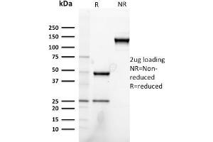 SDS-PAGE Analysis Purified Heregulin-1 Mouse Monoclonal Antibody (NRG1/2752). (Neuregulin 1 anticorps  (AA 21-242))