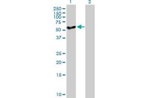 Western Blot analysis of CYP27A1 expression in transfected 293T cell line by CYP27A1 MaxPab polyclonal antibody.