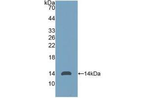 Western blot analysis of recombinant Human AMH. (AMH anticorps  (AA 453-560))