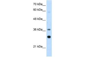 WB Suggested Anti-RPLP0 Antibody Titration:  2. (RPLP0 anticorps  (Middle Region))