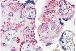 Human Placenta (formalin-fixed, paraffin-embedded) stained with C5AR1 antibody ABIN461687 followed by biotinylated goat anti-rabbit IgG secondary antibody ABIN481713, alkaline phosphatase-streptavidin and chromogen. (C5AR1 anticorps  (Internal Region))