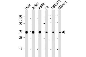 All lanes : Anti-GDH Antibody at 1:8000 dilution Lane 1: Hela whole cell lysate Lane 2: Jurkat whole cell lysate Lane 3: A549 whole cell lysate Lane 4: C6 whole cell lysate Lane 5: NIH/3T3 whole cell lysate Lane 6: mouse brain lysate Lysates/proteins at 20 μg per lane. (GAPDH anticorps  (AA 43-335))