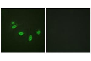 Immunofluorescence analysis of HeLa cells, using ETS1 (Phospho-Thr38) antibody. (ETS1 anticorps  (pThr38))