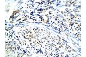 Formalin-fixed and paraffin embedded human uterine endomysium labeled with Anti-RAMP1 Polyclonal Antibody, Unconjugated (ABIN731438) followed by conjugation to the secondary antibody and DAB staining (RAMP1 anticorps  (AA 118-148))