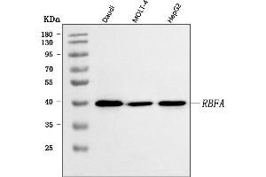 Western blot analysis of C18orf22/RBFA using anti-C18orf22/RBFA antibody (ABIN7600106). (RBFA anticorps  (AA 15-319))