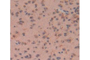 Used in DAB staining on fromalin fixed paraffin- embedded brain tissue