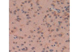 Used in DAB staining on fromalin fixed paraffin- embedded brain tissue (Calpain 5 anticorps  (AA 26-343))
