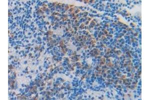 Detection of FBLN4 in Mouse Spleen Tissue using Polyclonal Antibody to Fibulin 4 (FBLN4)