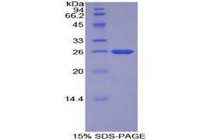 SDS-PAGE analysis of Cow TFPI2 Protein.