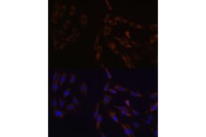 Immunofluorescence analysis of C6 cells using SUCLG2 Polyclonal Antibody  at dilution of 1:100 (40x lens).