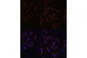 Immunofluorescence analysis of C6 cells using SUCLG2 Polyclonal Antibody  at dilution of 1:100 (40x lens). (SUCLG2 anticorps  (AA 50-300))