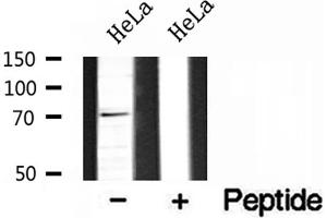 Western blot analysis of extracts of HeLa cells, using BRD7 antibody. (BRD7 anticorps  (Internal Region))