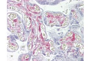 Anti-LGALS1 / Galectin 1 antibody IHC of human placenta.