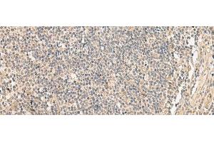 Immunohistochemistry of paraffin-embedded Human tonsil tissue using PAF1 Polyclonal Antibody at dilution of 1:45(x200)